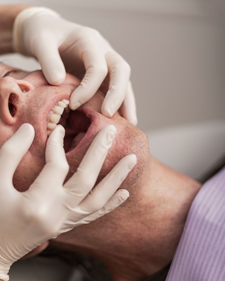 Rehabilitación sobre implantes