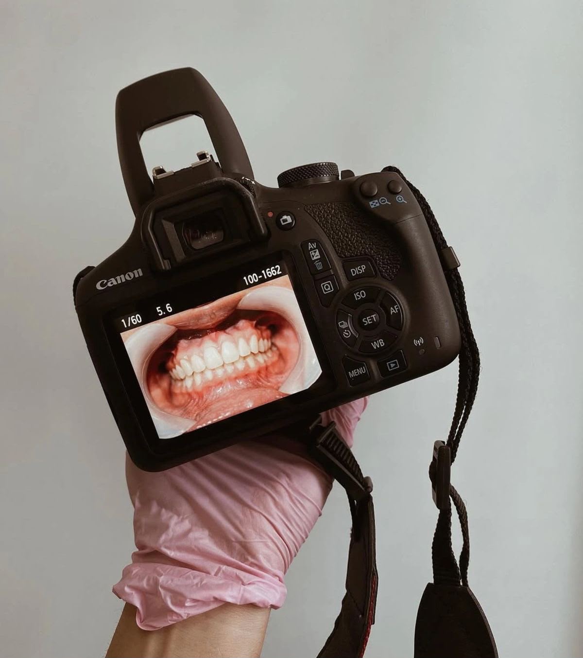 Estética Dental