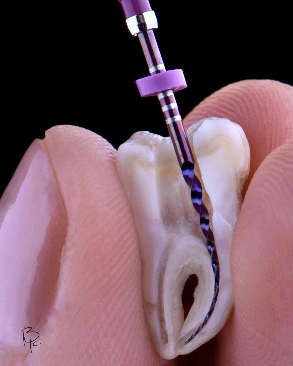 Endodoncia